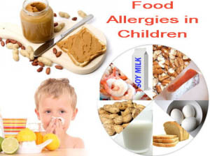 food allergies in children