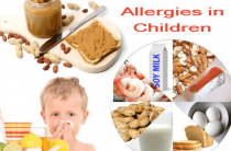 Аллергенные продукты для детей